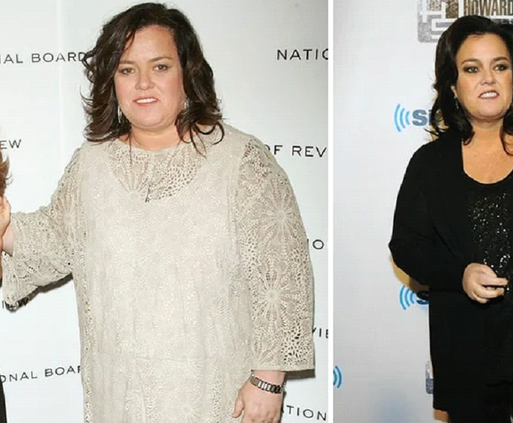 Celebrities who had weight loss surgery Celebrities who had weight loss surgery